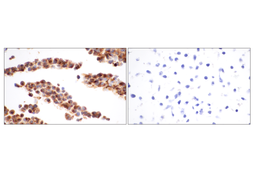  Image 41: LRP1-mediated Endocytosis and Transmission of Tau Antibody Sampler Kit