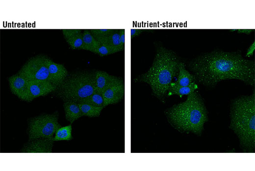 Immunofluorescence Image 1: Atg13 (E1Y9V) Rabbit mAb