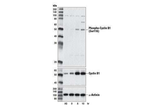 Western Blotting Image 2: Phospho-Cyclin B1 (Ser116) Antibody