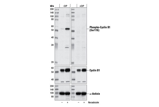 Western Blotting Image 3: Phospho-Cyclin B1 (Ser116) Antibody