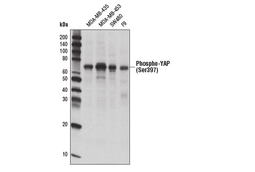  Image 10: PhosphoPlus® YAP (Ser397) Antibody Duet