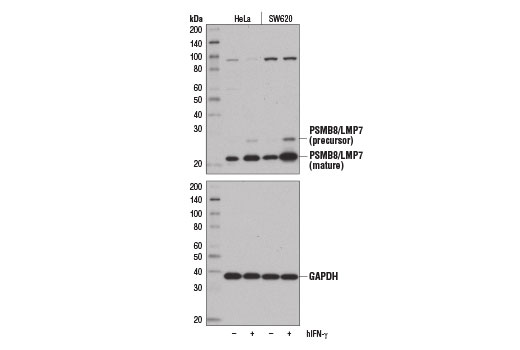  Image 16: MHC Class I Antigen Processing and Presentation Antibody Sampler Kit