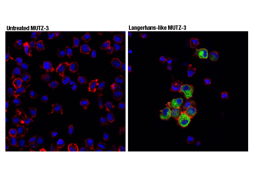 Immunofluorescence Image 1: Langerin (D9H7R) XP® Rabbit mAb