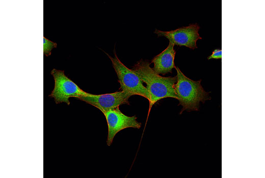 Immunofluorescence Image 1: Stathmin (D1Y5A) Rabbit mAb