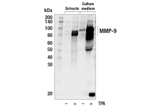  Image 16: ECM Profiling Antibody Sampler Kit