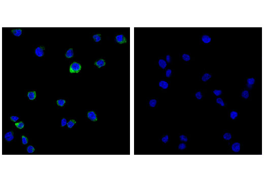 Immunofluorescence Image 1: Toll-like Receptor 9 (D9M9H) XP® Rabbit mAb