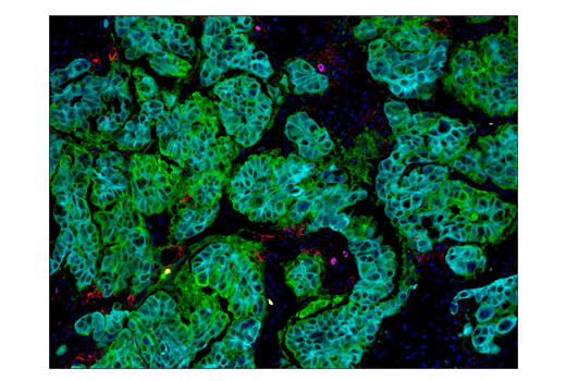 Immunohistochemistry Image 7: PD-L1 (E1L3N®) XP® Rabbit mAb