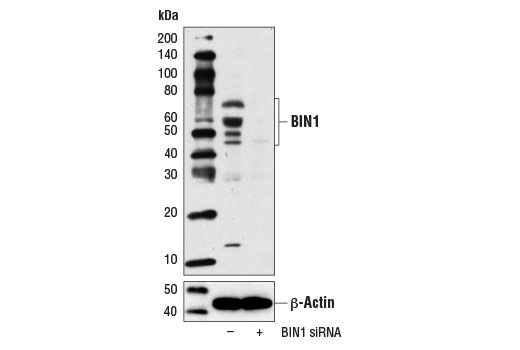  Image 1: SignalSilence® BIN1 siRNA I