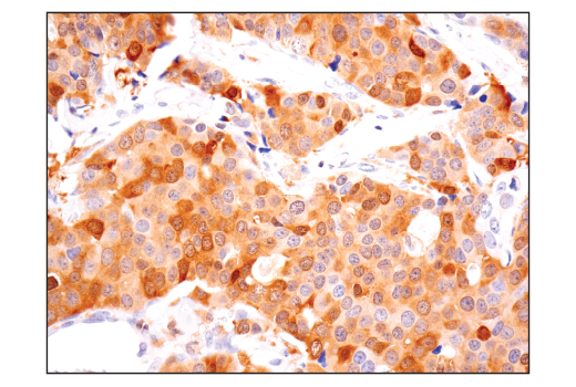 Immunohistochemistry Image 1: ASC/TMS1 (E1E3I) Rabbit mAb