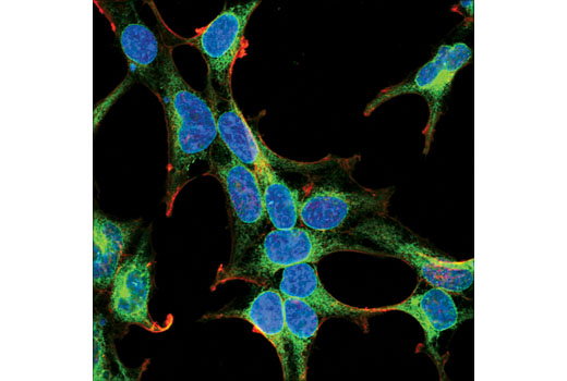 Immunofluorescence Image 1: PGRMC1 (D6M5M) XP® Rabbit mAb