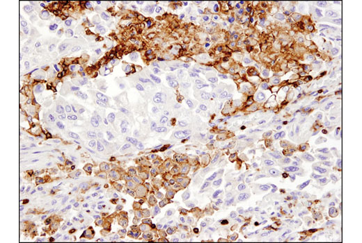Immunohistochemistry Image 1: CD45 (Intracellular Domain) (D9M8I) XP® Rabbit mAb