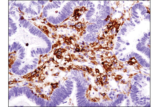 Immunohistochemistry Image 2: CD45 (Intracellular Domain) (D9M8I) XP® Rabbit mAb