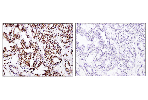 Immunohistochemistry Image 4: Acetyl-Histone H3 (Lys18) (D8Z5H) Rabbit mAb