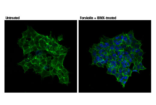 Immunofluorescence Image 2: Phospho-CREB (Ser133) (87G3) Rabbit mAb (Alexa Fluor® 647 Conjugate)
