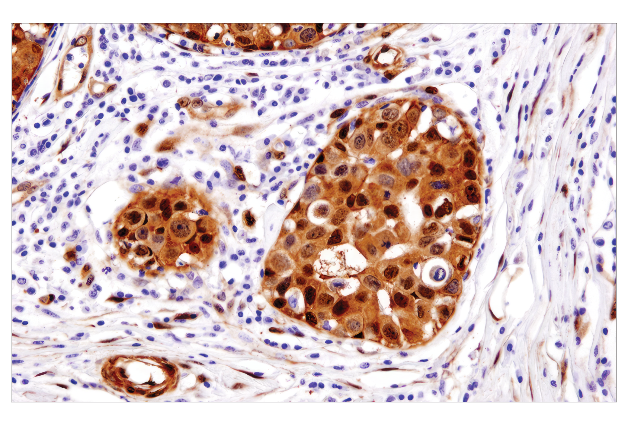  Image 54: Small Cell Lung Cancer Biomarker Antibody Sampler Kit
