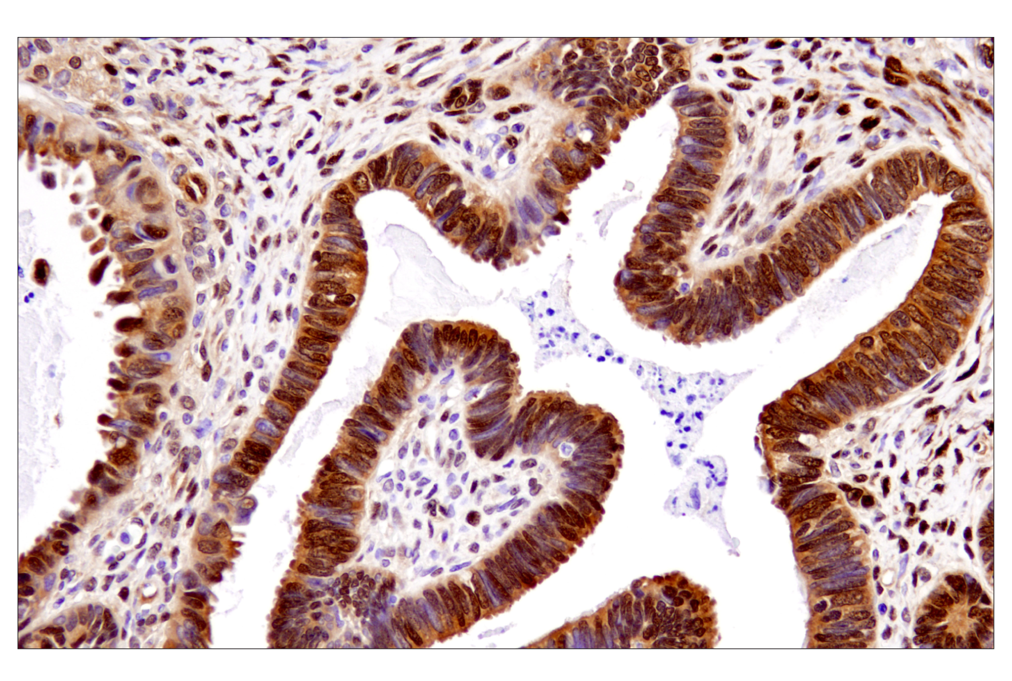 Image 17: PhosphoPlus® YAP (Ser397) Antibody Duet