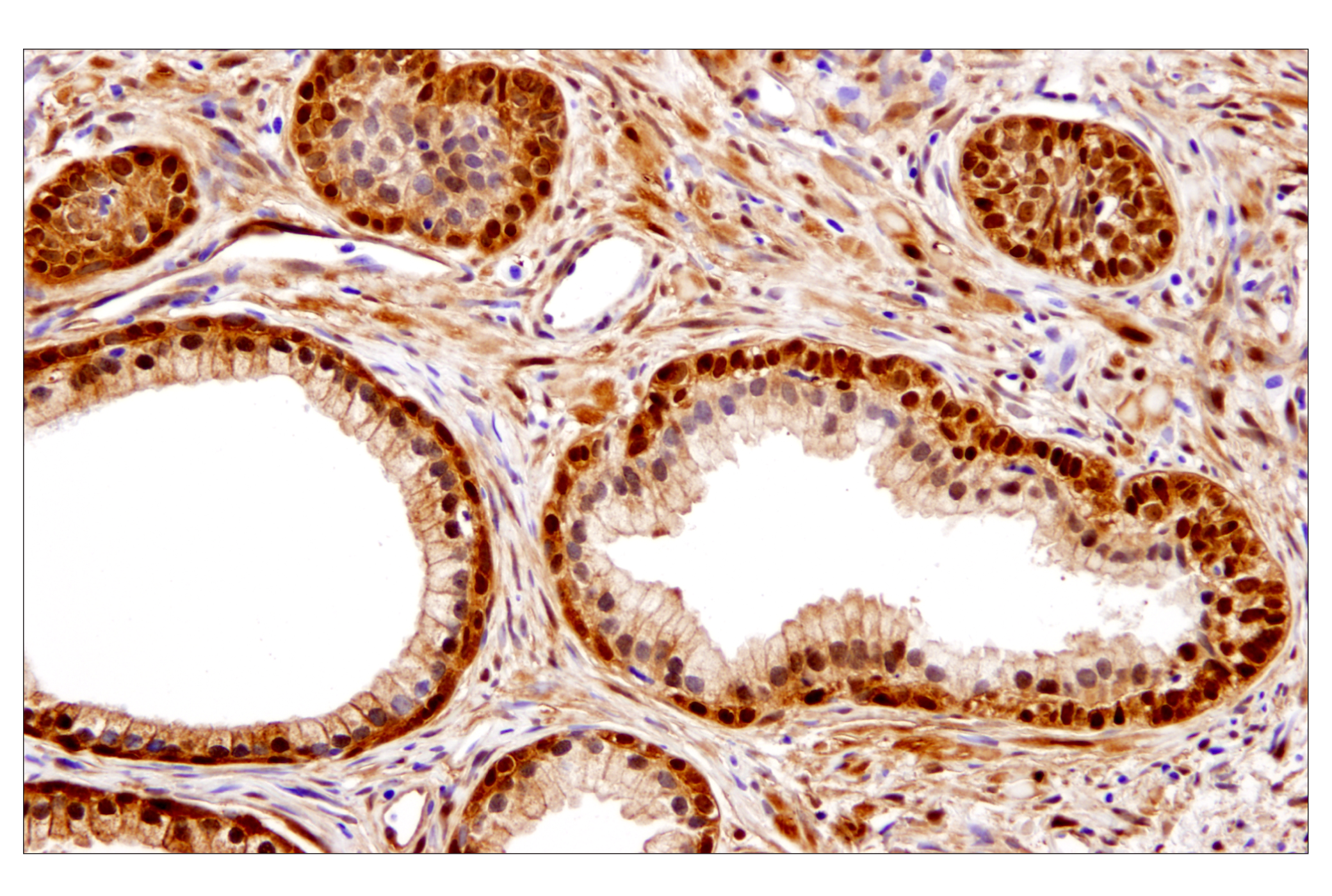  Image 68: Small Cell Lung Cancer Biomarker Antibody Sampler Kit