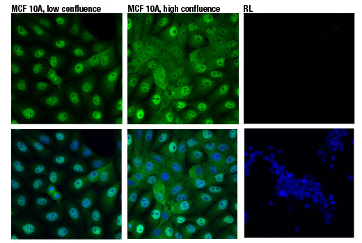  Image 32: Hippo Pathway: Upstream Signaling Antibody Sampler Kit