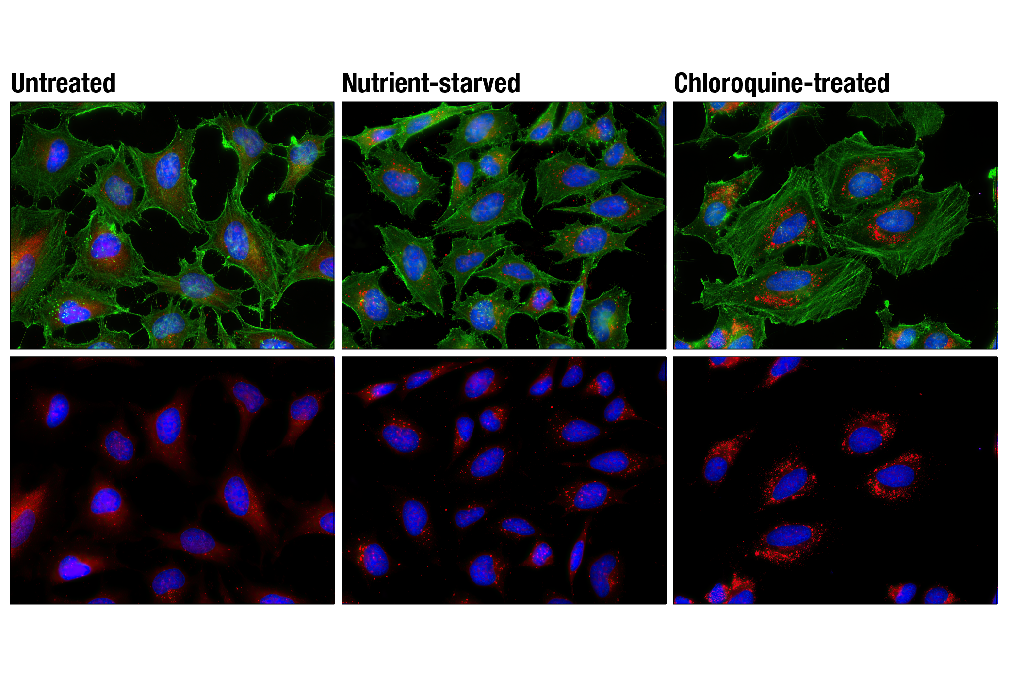 Immunofluorescence Image 1: LC3A/B (D3U4C) XP® Rabbit mAb (Alexa Fluor® 594 Conjugate)
