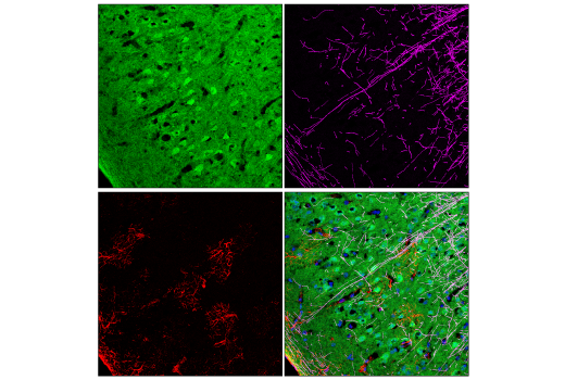 Immunofluorescence Image 2: CDK5 (D1F7M) Rabbit mAb