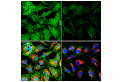 Immunofluorescence Image 4: CDK5 (D1F7M) Rabbit mAb