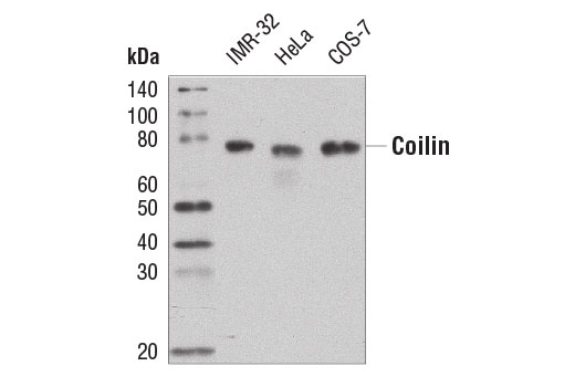 Western Blotting Image 1: Coilin (D2L3J) XP® Rabbit mAb