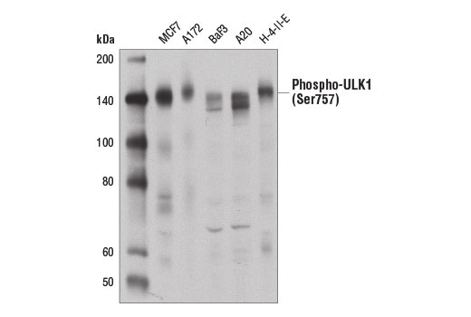  Image 12: ULK1 Substrate Antibody Sampler Kit