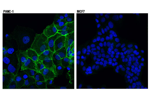 Immunofluorescence Image 1: N-Cadherin (13A9) Mouse mAb