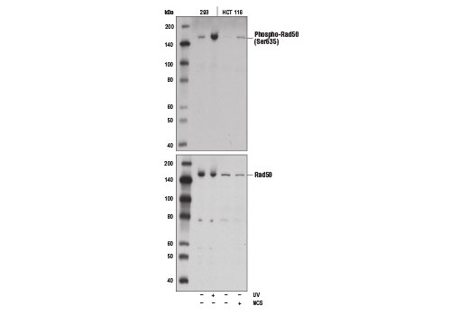 Western Blotting Image 1: Phospho-Rad50 (Ser635) Antibody