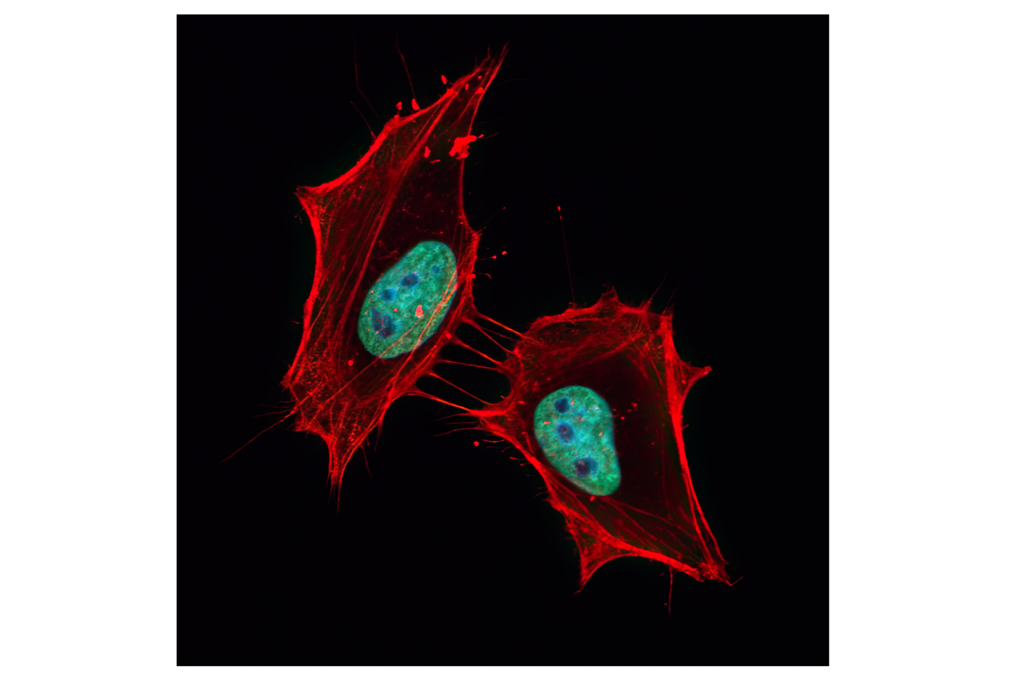 Immunofluorescence Image 3: Histone H3 (1B1B2) Mouse mAb