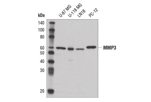  Image 5: Senescence Associated Secretory Phenotype (SASP) Antibody Sampler Kit