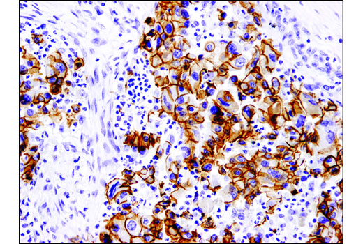 Immunohistochemistry Image 1: E-Cadherin (4A2) Mouse mAb