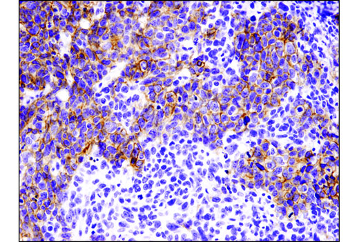 Immunohistochemistry Image 4: E-Cadherin (4A2) Mouse mAb