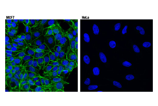 Immunofluorescence Image 1: E-Cadherin (4A2) Mouse mAb