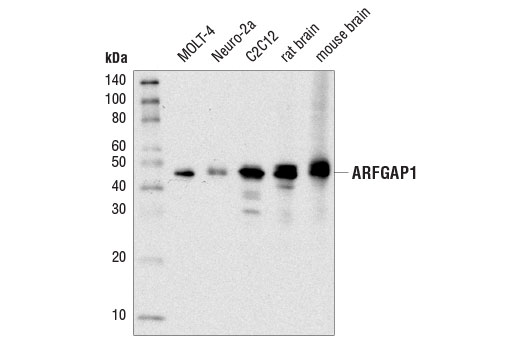 Western Blotting Image 1: ARFGAP1 (D4C2M) Rabbit mAb