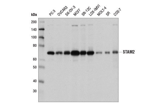 Western Blotting Image 1: STAM2 Antibody