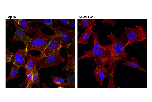Immunofluorescence Image 1: MRP1/ABCC1 (D7O8N) Rabbit mAb