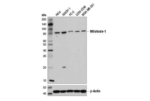 Western Blotting Image 1: Mitofusin-1 (D6E2S) Rabbit mAb