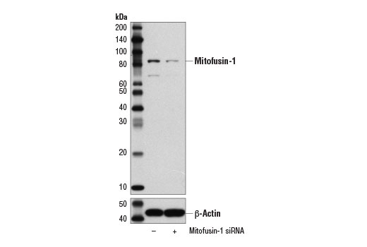 Western Blotting Image 2: Mitofusin-1 (D6E2S) Rabbit mAb