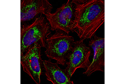 Immunofluorescence Image 1: Mitofusin-1 (D6E2S) Rabbit mAb