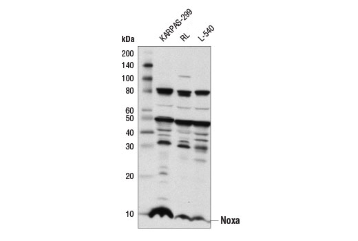  Image 9: Pro-Apoptosis Bcl-2 Family Antibody Sampler Kit II