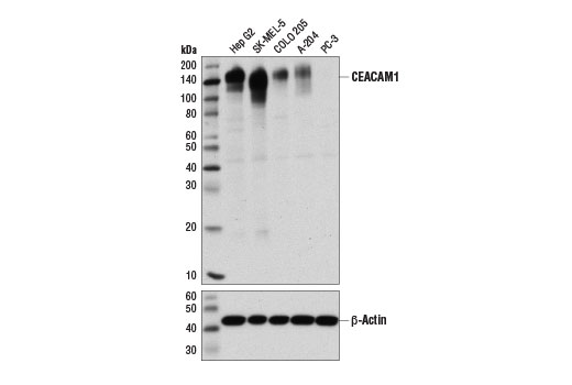 Western Blotting Image 1: CEACAM1 (D1P4T) Rabbit mAb
