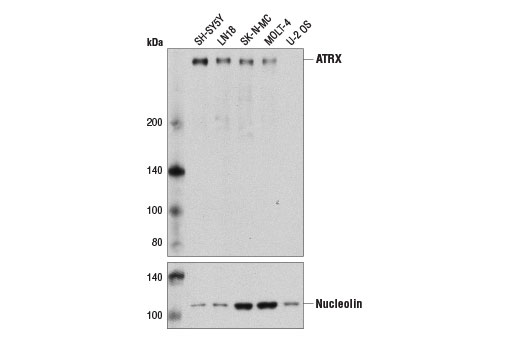  Image 2: ATRX/Daxx Antibody Sampler Kit