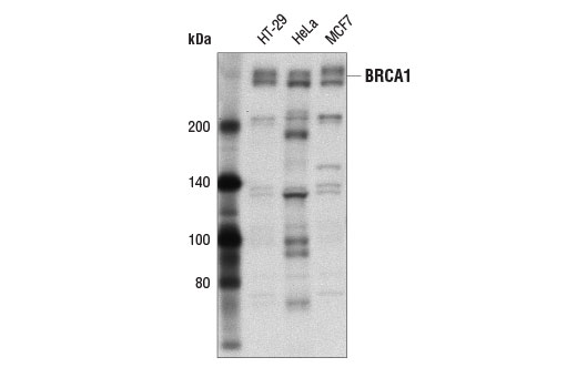 Western Blotting Image 1: BRCA1 (A8X9F) Rabbit mAb