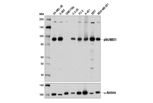  Image 5: Homologous Recombination (HR) DNA Repair Antibody Sampler Kit