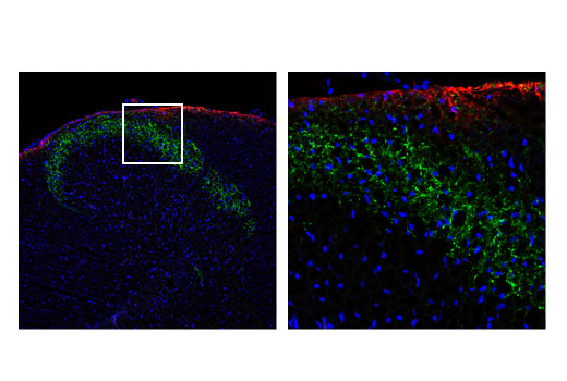 Immunofluorescence Image 1: CGRP (D5R8F) Rabbit mAb