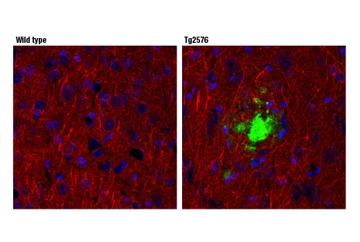 Immunofluorescence Image 1: β-Amyloid (1-42) (D9A3A) Rabbit mAb