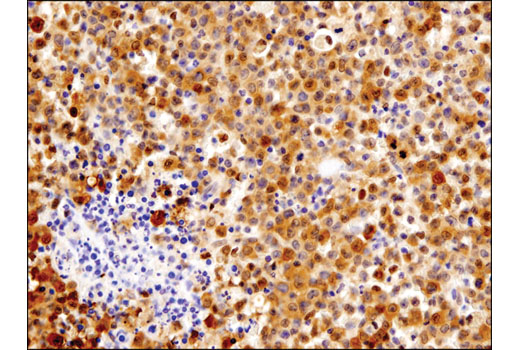  Image 13: PhosphoPlus® Stat1 (Tyr701) Antibody Duet