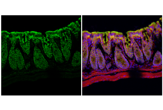 Immunofluorescence Image 2: MCU (D2Z3B) Rabbit mAb