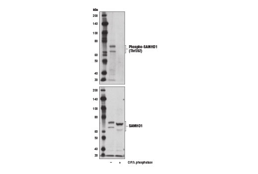 Western Blotting Image 2: Phospho-SAMHD1 (Thr592) Antibody
